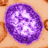 Measles Virus (Photo Credit: Cynthia Goldsmith)