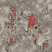 Zika virus particles (red) shown in African green monkey kidney cells. Courest Zika virus particles (red) shown in African green monkey kidney cells. (Image courtesy NIAID)